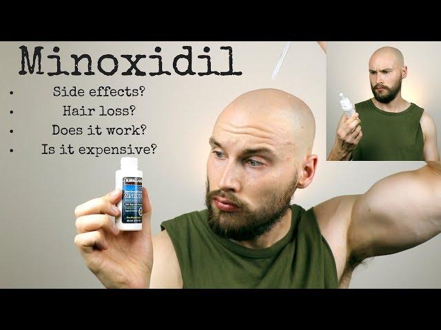 WHAT IS MINOXIDIL? Does it work? Should you use it?