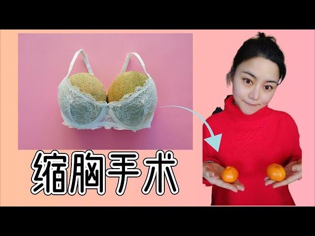 缩胸 | 我的缩胸手术分享， Breast Reduction Surgery Review