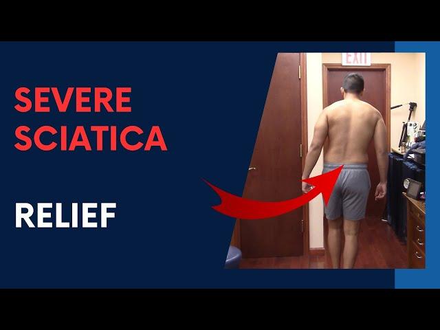 SEVERE Sciatica RELIEF by Dr Suh