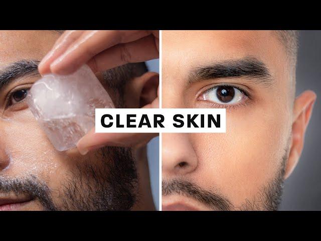 How To Get Clear Skin (Science Based)