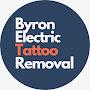 @ByronElectricTattooRemoval