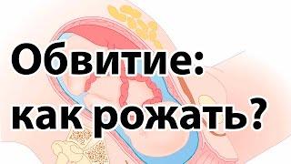 Обвитие пуповиной: как рожать? | Естественные роды при обвитии пуповиной | "До и После Родов"