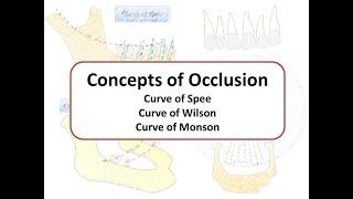 Concepts of Occlusion: Curve of Spee, Wilson & Monson