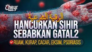 HANCURKAN SIHIR SEBABKAN GATAL GATAL - AYAT RUQYAH - RUAM KURAP CACAR EKSIM - الرقية الشرعية