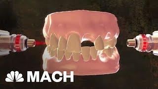 New Stem Cell Research Could Put An End To Dental Visits | Mach | NBC News