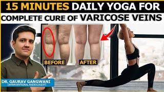 EXERCISE FOR VARICOSE VEINS | YOGA FOR VARICOSE VEINS | Dr. Gaurav Gangwani