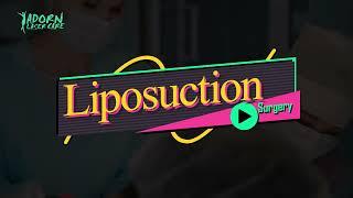 Liposuction at Adorn Laser Care | Adorn Laser Care | Liposuction