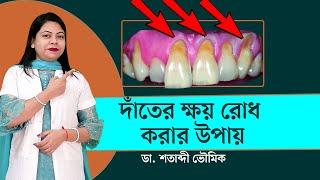 দাঁতের ক্ষয় রোধ করার উপায় || Tooth decay pain solution || Dr. Shatabdi Bhowmik  ||