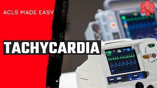 ACLS Tachycardia Algorithm