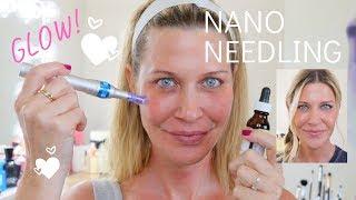 ️Nano Needling | How to needle at home for SERIOUS glow!!