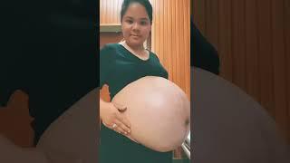 pregnant twins #bumil #pregação #embarazo