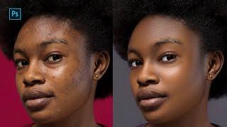 Learn High End retouching like a pro in 2025