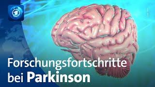 Welt-Parkinson-Tag: Was sich in der Forschung tut