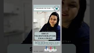 What can you achieve in 20days!Smile transformation #dentist #drsonalyerpude #smilemakeover #dental
