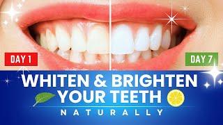 Best Home Remedies to Whiten Teeth in 7 Days!