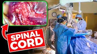 INSIDE THE OR: Anterior Cervical Discectomy & Fusion (ACDF)