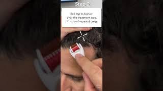 How To Use The StimuRoller (Derm Roller / Micro needling) for Hair Loss & Stimulate Hair Growth