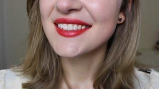 My Teeth Before The Veneers....  | Teeth Transformation - How Much Does It Cost?