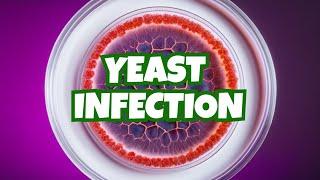 Understanding Yeast Infections: Causes and Imbalance in Candida Fungus