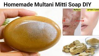 100% Natural Multani Mitti Soap to get rid of Acne, Pimples & Dark Spots | Skin Whitening Soap DIY