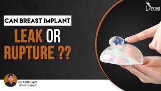 Can Breast Implant Leak or Rupture? Sebbin and Motiva Implants | Dr. Amit Gupta