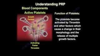 Platelet Rich Plasma Therapy - Everything You Need To Know - Dr. Nabil Ebraheim