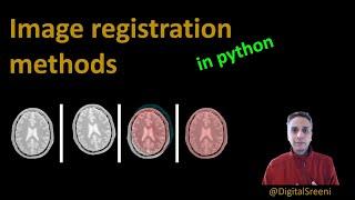 120 - Image registration methods in python