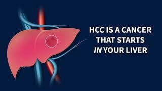 Primary Liver Cancer - Understanding HCC