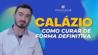 Como Curar o CALÁZIO de forma DEFINITIVA | Dr. Tiago César Oftalmologista em Belo Horizonte