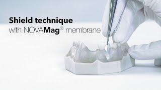 Shield technique with NOVAMag® membrane