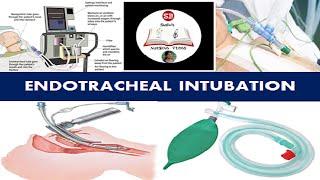 ENDOTRACHEAL INTUBATION- Types, Indications, Procedure,Medical and Nursing Management I QUICK REVIEW