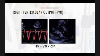 Neonatal Echocardiography (part 2), by Dr Ahmed Tharwat