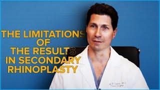 Dr. Jay Calvert explains the Limitations of the Results in Secondary Rhinoplasty