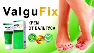 Избавьтесь от косточки на ноге без операции за 1 курс с кремом ValguFix! #косточкананоге #вальгус