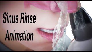 Sinus Rinse Animation