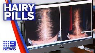 New pill to treat hair loss | Nine News Australia