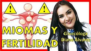 MIOMAS FERTILIDAD Y EMBARAZO |Ginecologa Diana Alvarez