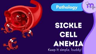 Sickle cell anemia | symptoms | analysis| oral manifestations| Management | General pathology