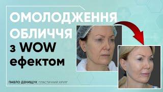 ПІДТЯЖКА ОБЛИЧЧЯ — КОМПЛЕКСНИЙ ПІДХІД ДО ОМОЛОДЖЕННЯ #підтяжка