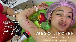 MESO LIPO + RF CAVITATION | NON SURGICAL LIPO TREATMENT