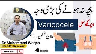 Varicocele Kia ha| Banjh pun ki wajuhat | Best Surgery for Varicocele