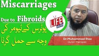 Miscarriages Due to Fibroids, Treatment with Quran Therapy | Life Skills TV