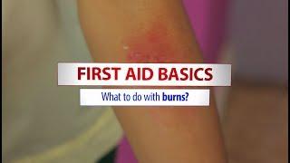 Basic first aid treatment for burns