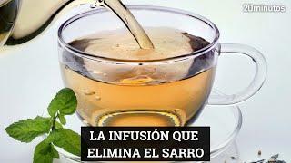 LA INFUSIÓN QUE ELIMINA EL SARRO de forma rápida y natural