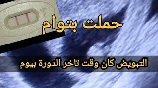 حملت بتوام فالروطار اعراض التبويض المتأخر ردو البال ممكن تكون بويضة بعد الاباضة