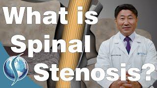 What is Spinal Stenosis?