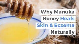 Why Manuka Honey Heals Eczema, Psoriasis, & Wounds | The Best Natural Cream for Eczema