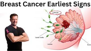 Earliest Signs of Breast Cancer [Doctor Explains] 2024