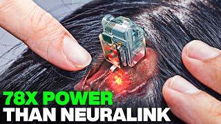 ALL NEW Brain Chip Breakthrough SHOCKS The Entire Industry!