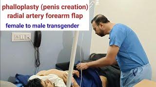 Phalloplasty for female to male transgenders by radial artery forearm flap  INDIA USA UK BANGLADESH